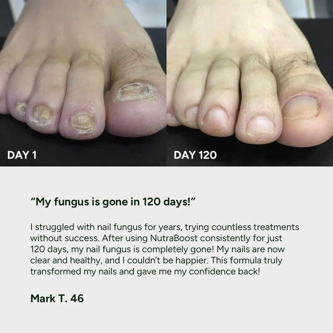 imgi_10_nail-fungus-treatment-gel-review