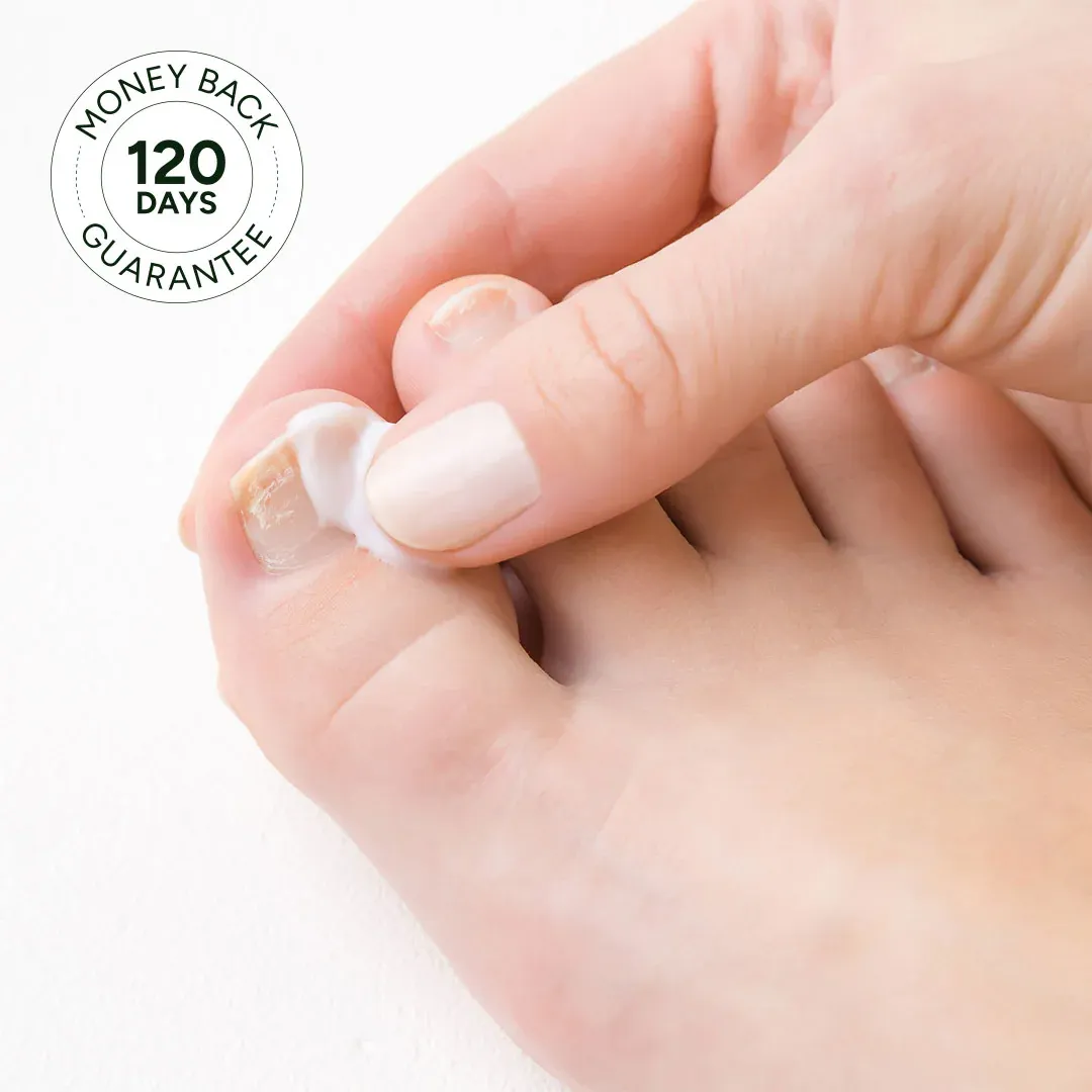 imgi_46_nail-fungus-treatment-gel-faqs