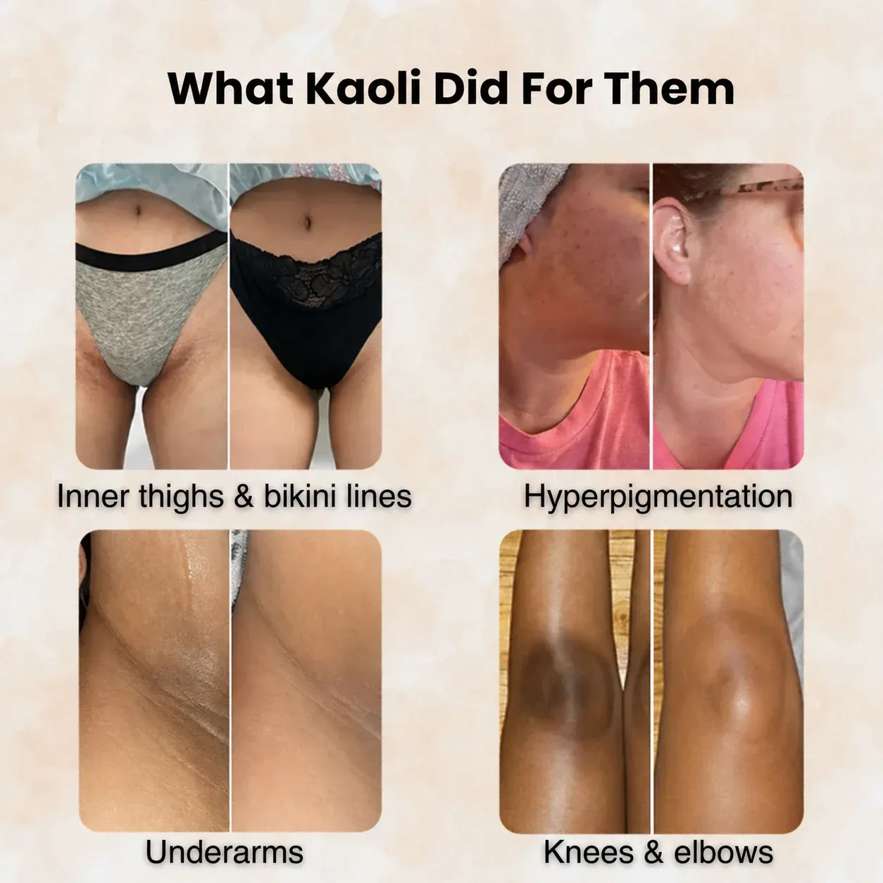 imgi_47_What_Koali