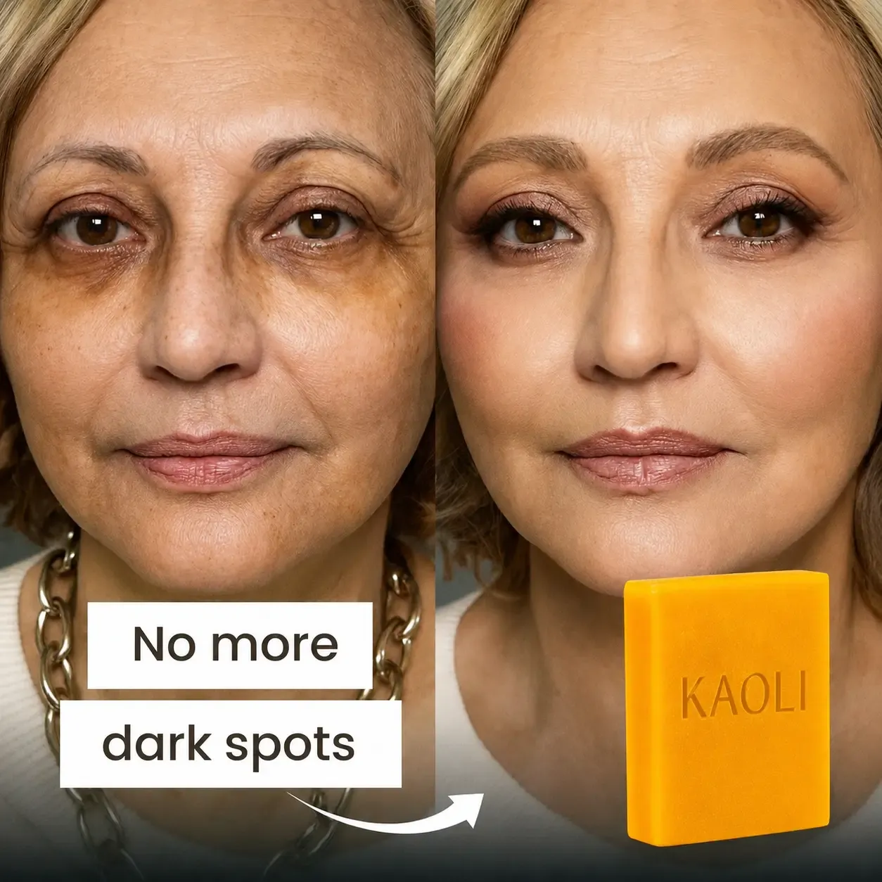 imgi_92_Before_after_dark_spots